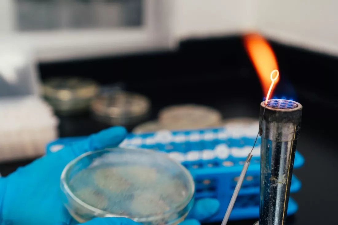Mani con guanti reggono una piastra di Petri accanto alla fiamma di un becco in laboratorio.